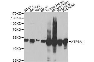 Western blot analysis of extracts of various cell lines, using ATP5A1 Antibody.