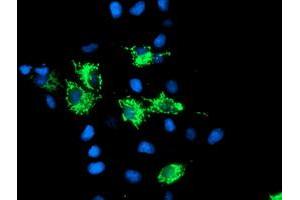 Anti-SIRT5 mouse monoclonal antibody (ABIN2454823) immunofluorescent staining of COS7 cells transiently transfected by pCMV6-ENTRY SIRT5 (RC200189). (SIRT5 抗体)