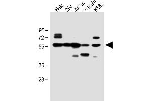 All lanes : Anti-IFNAR1 Antibody (Center) at 1:1000 dilution Lane 1: Hela whole cell lysate Lane 2: 293 whole cell lysate Lane 3: Jurkat whole cell lysate Lane 4: H. (IFNAR1 抗体  (AA 162-188))