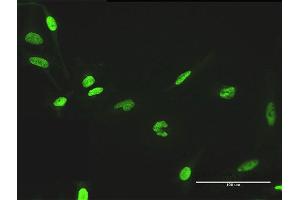 Immunofluorescence of purified MaxPab antibody to ZNF530 on HeLa cell. (ZNF530 抗体  (AA 1-599))