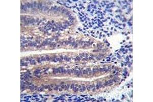 ANGPTL7 antibody immunohistochemistry analysis in formalin fixed and paraffin embedded human uterus tissue. (ANGPTL7 抗体  (AA 300-350))