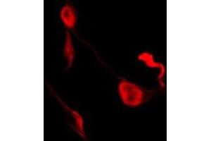 ABIN6278651 staining K562 by IF/ICC. (Ephrin B1/B2/B3 (pTyr324) 抗体)