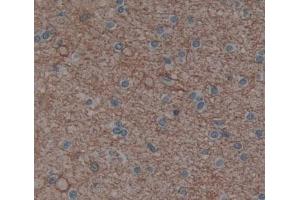 Used in DAB staining on fromalin fixed paraffin- embedded brain tissue (PLCH1 抗体  (AA 1-237))