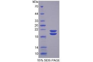 SDS-PAGE of Protein Standard from the Kit  (Highly purified E. (SFTPD ELISA 试剂盒)