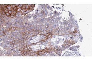 Immunohistochemistry (IHC) image for anti-Transient Receptor Potential Cation Channel, Subfamily M, Member 7 (TRPM7) (C-Term) antibody (ABIN6265753)