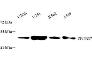 Western blot analysis of ZBTB37 (ABIN7076249) at dilution of 1: 2000 (ZBTB37 抗体)