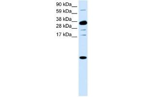CXCL1 antibody (70R-10502) used at 0.
