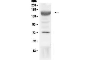 Western blot analysis of IGF1 Receptor using anti-IGF1 Receptor antibody . (IGF1R 抗体  (AA 31-257))