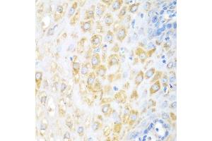 Immunohistochemistry of paraffin-embedded human esophagus using BECN1 antibody at dilution of 1:100 (40x lens). (Beclin 1 抗体)