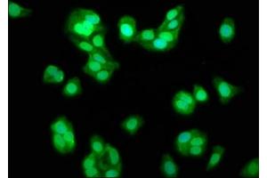 Immunofluorescence staining of HepG2 cells with ABIN7164441 at 1:133, counter-stained with DAPI. (TRIM8 抗体  (AA 367-517))