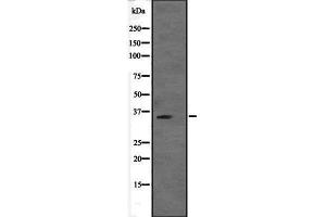 Western blot analysis of VGLL2 expression in VGLL2 transfected 293T cell lysate,The lane on the left is treated with the antigen-specific peptide. (VGLL2 抗体  (Internal Region))