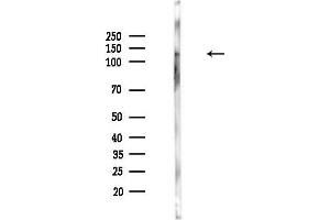 anti-Anillin, Actin Binding Protein (ANLN) (C-Term) antibody