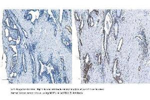 IHC analysis of METTL14 using anti-METTL14 antibody (ABIN7599817).