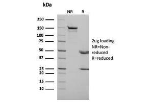 SDS-PAGE Analysis Purified p73 Mouse Monoclonal Antibody (P73/2531).