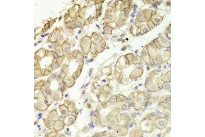 Immunohistochemistry (IHC) image for anti-Catenin (Cadherin-Associated Protein), delta 1 (CTNND1) (AA 573-832) antibody (ABIN3022309)