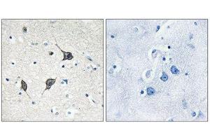 Immunohistochemistry (IHC) image for anti-G Protein-Coupled Receptor 20 (GPR20) (C-Term) antibody (ABIN1853030) (GPR20 抗体  (C-Term))