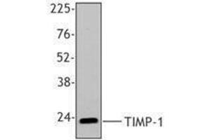Western Blotting (WB) image for anti-TIMP Metallopeptidase Inhibitor 1 (TIMP1) antibody (ABIN2666373) (TIMP1 抗体)