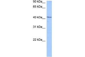 WB Suggested Anti-DCP2 Antibody Titration:  0. (DCP2 抗体  (C-Term))