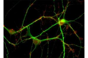 Indirect immunofluorescence labeling of PFA fixed rat hippocampus neurons with anti-synaptogyrin (dilution 1 : 500; red) and anti-MAP 2 (cat. (Synaptogyrin 1 抗体  (AA 220-234))
