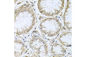 Immunohistochemistry of paraffin-embedded human stomach using HPS1 antibody. (HPS1 抗体)