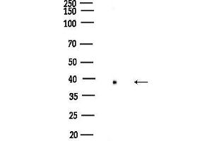 Western blot analysis of lysates from K562 cells, using Phospho-Nucleophosmin (Thr199) Antibody at 1/1000 dilution.