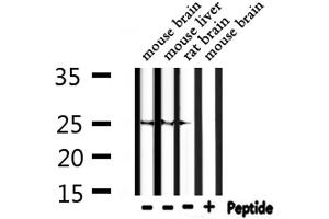 Western blot analysis of extracts from mouse brain, mouse liver, rat brain, using RND2 Antibody. (RND2 抗体  (Internal Region))