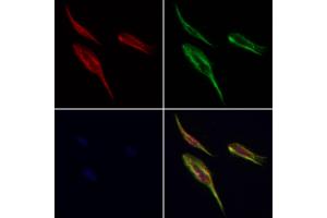 Ribophorin I Antibody staining Hela cells by IF/ICC. (RPN1 抗体  (C-Term))
