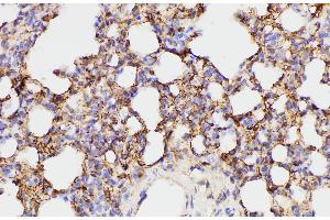 Immunohistochemistry of paraffin-embedded Rat lung using FGA Polycloanl Antibody at dilution of 1:100 (FGA 抗体)