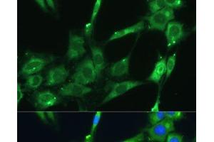 Immunofluorescence analysis of C6 cells using SPARC Polyclonal Antibody at dilution of 1:100 (40x lens).