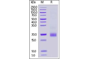 Cynomolgus CD3E&CD3G Heterodimer Protein, His Tag&Tag Free on  under reducing (R) condition.