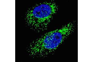Fluorescent image of  cells stained with LC3 (G8A)  antibody. (MAP1LC3A 抗体  (AA 91-117))