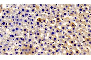 Detection of AZIN1 in Rat Liver Tissue using Polyclonal Antibody to Antizyme Inhibitor 1 (AZIN1) (Antizyme Inhibitor 1 抗体  (AA 1-280))