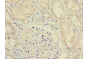 Immunohistochemistry of paraffin-embedded human kidney tissue using ABIN7166095 at dilution of 1:100 (SAV1 抗体  (AA 1-210))