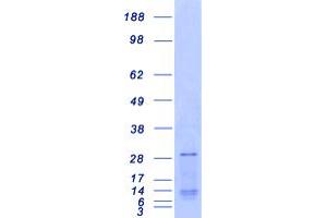 Western Blotting (WB) image for Synovial Sarcoma, X Breakpoint 1 (SSX1) protein (Myc-DYKDDDDK Tag) (ABIN2732723)