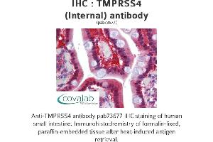 Image no. 1 for anti-Transmembrane Protease, serine 4 (TMPRSS4) (Internal Region) antibody (ABIN1740176) (TMPRSS4 抗体  (Internal Region))