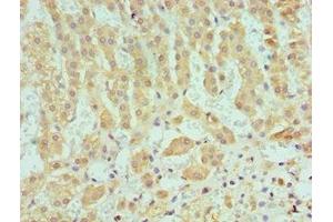 Immunohistochemistry (IHC) image for anti-serpin Peptidase Inhibitor, Clade A (Alpha-1 Antiproteinase, Antitrypsin), Member 1 (SERPINA1) (AA 165-444) antibody (ABIN7166366)