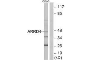 Western blot analysis of extracts from COLO cells, using ARRD4 Antibody. (ARRD4 抗体  (AA 127-176))