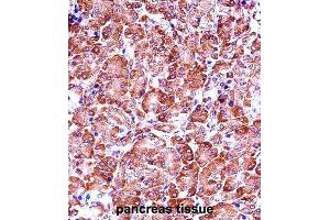 Immunohistochemistry (IHC) image for anti-Matrix Metallopeptidase 28 (MMP28) antibody (ABIN2997500) (MMP28 抗体)
