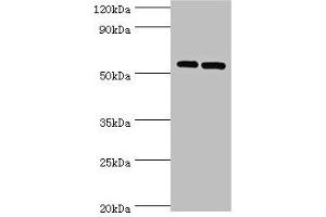 Western blot All lanes: PNPLA2 antibody at 10 μg/mL Lane 1: A431 whole cell lysate Lane 2: Hela whole cell lysate Secondary Goat polyclonal to rabbit IgG at 1/10000 dilution Predicted band size: 56, 20 kDa Observed band size: 56 kDa (PNPLA2 抗体  (AA 265-504))