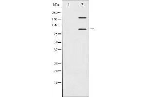 Western blot analysis of IGF1R expression in Insulin treated 293 whole cell lysates,The lane on the left is treated with the antigen-specific peptide. (IGF1R 抗体  (C-Term))