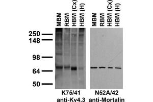 Immunoblots on brain membranes prepared from whole rat (RBM) and mouse (MBM) brain, and from human cerebral cortex [HBM(Cx)], and hippocampus [HBM(H)].