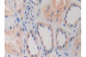 Immunohistochemistry (IHC) image for anti-Glycine Dehydrogenase (GLDC) (AA 81-268) antibody (ABIN7438277)