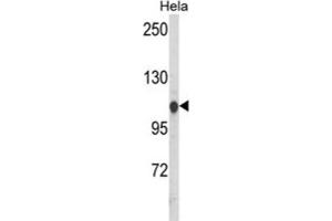 Western Blotting (WB) image for anti-Heat Shock 70kDa Protein 4-Like (HSPA4L) antibody (ABIN3003894) (HSPA4L 抗体)