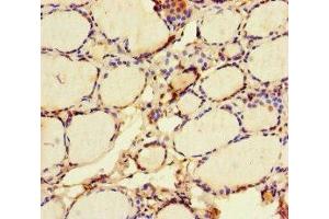 Immunohistochemistry of paraffin-embedded human thyroid tissue using ABIN7172419 at dilution of 1:100 (VGLL4 抗体  (AA 43-277))