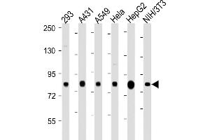 Western Blotting (WB) image for anti-Ribosomal Protein S6 Kinase, 90kDa, Polypeptide 3 (RPS6KA3) (AA 342-376), (Ser369) antibody (ABIN6242552)
