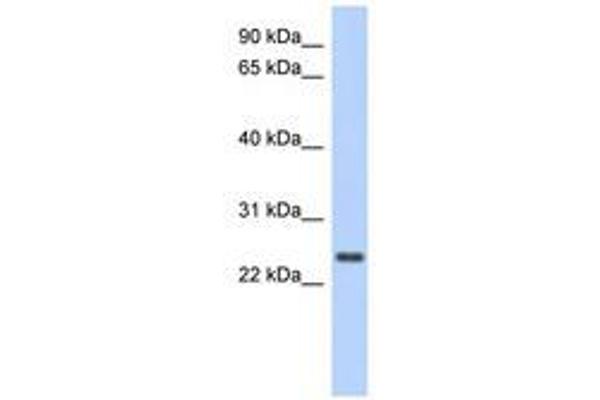 CCDC70 抗体  (AA 71-120)