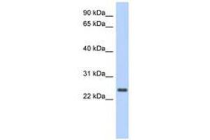 Image no. 1 for anti-Coiled-Coil Domain Containing 70 (CCDC70) (AA 71-120) antibody (ABIN6741256) (CCDC70 抗体  (AA 71-120))