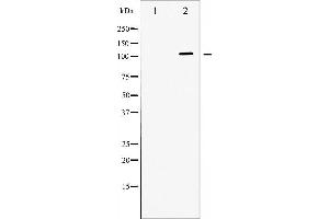 Western blot analysis of ATPase expression in PMA treated 293 whole cell lysates,The lane on the left is treated with the antigen-specific peptide. (ATP1A1 抗体  (N-Term))
