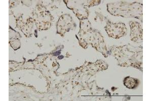 Image no. 1 for anti-Ets Variant 6 (ETV6) (AA 1-453) antibody (ABIN598674) (ETV6 抗体  (AA 1-453))