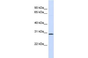 WB Suggested Anti-FGF14 Antibody Titration: 0. (FGF14 抗体  (Middle Region))